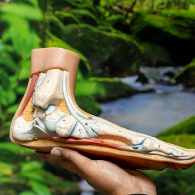 Foot anatomy model showing heel spur treatment in Toowoomba