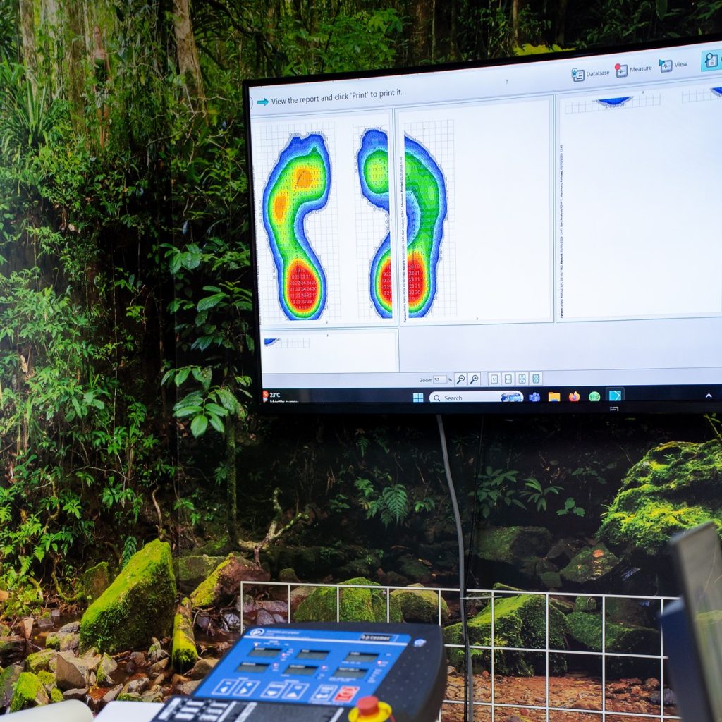 Zebris gait analysis used for Achilles tendonitis treatment in Toowoomba